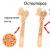 Диагностика остеопороза: лабораторные анализы, маркеры, виды обследований и тесты Анализ на остеопороз в инвитро