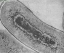 細菌増殖因子 細菌の分離方法